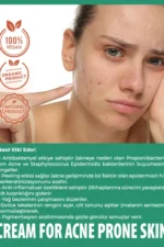 Akne karşıtı bakım kremi