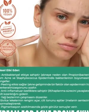 Akne karşıtı bakım kremi
